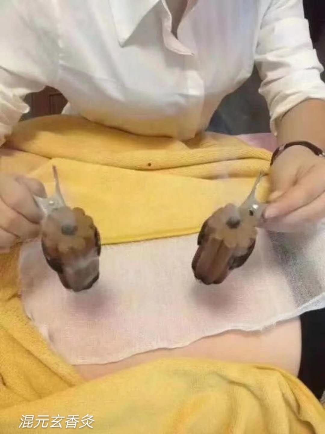 香养***调理三伏灸批发混元玄香香灸厂家生产销售