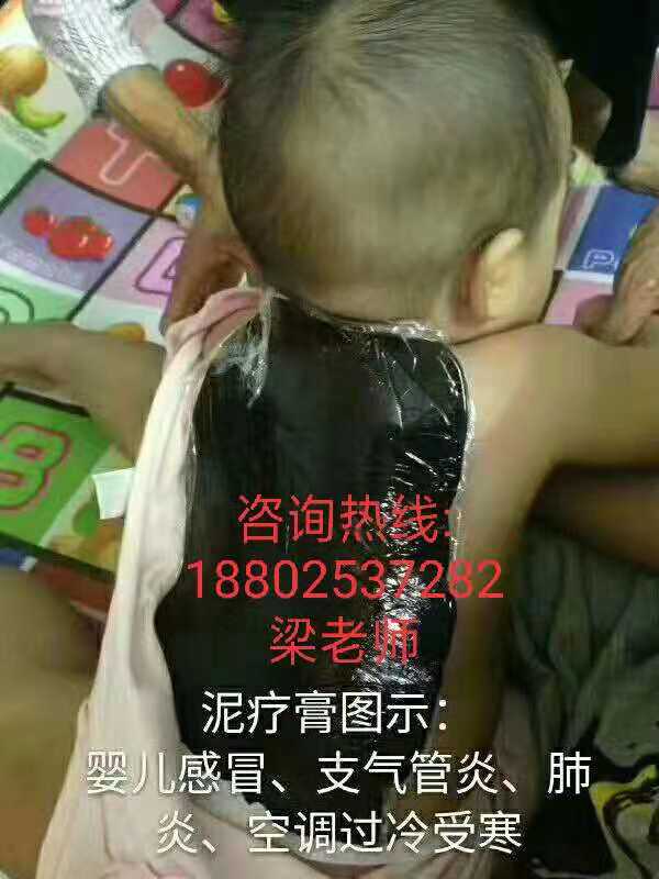 江门DDS生物电渗析技术培训机构
